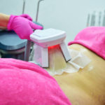 Cryolipolyse à Villefranche : une solution efficace contre les bourrelets dorsaux