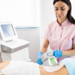 Quels résultats peut-on attendre après une cryolipolyse à Lyon ?