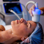 Est-ce que la cryolipolyse à Lyon est douloureuse pendant ou après la séance ?