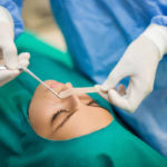 Quels signes indiquent une bonne cicatrisation après une rhinoplastie à Lyon ?