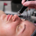 Existe-t-il un hydrafacial à Lyon réalisé par un médecin esthétique ?